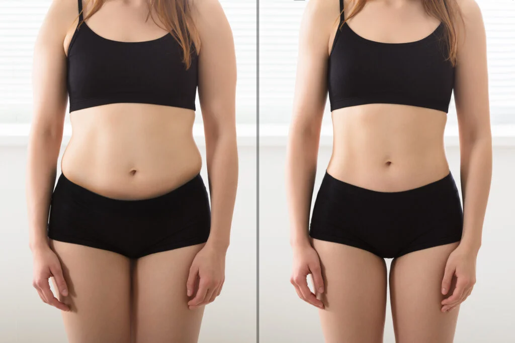 TALS-Clinton-Township-Tirzepatide-Weight-Loss